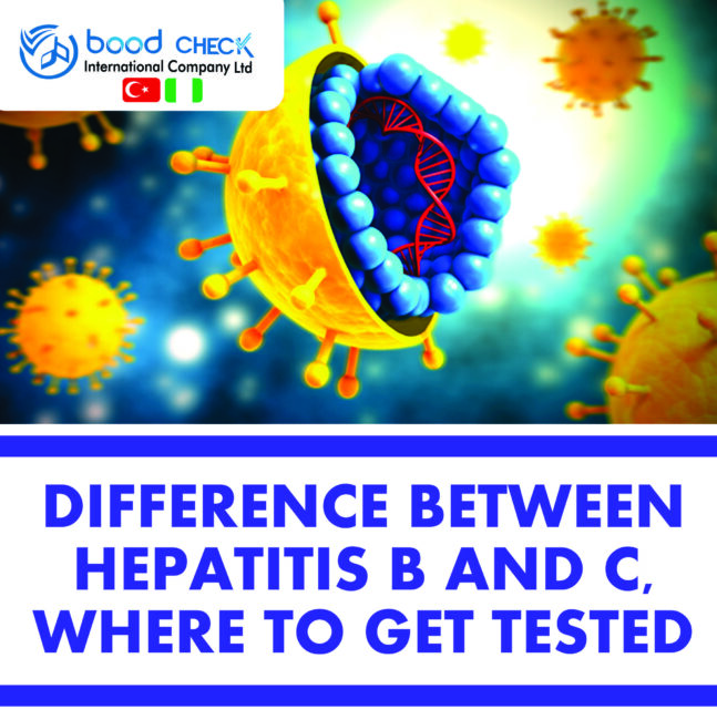 Difference Between Hepatitis B And C, Where To Get Tested In Kano State
