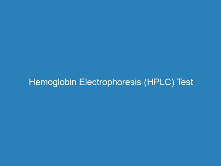 Hemoglobin Electrophoresis HPLC Test Investigation FREE Home Office   Hemoglobin Electrophoresis Hplc Test Investigation Free Home Office Sample Collection Boodcheck Medical Laboratory In Kano State Nigeria 2903 768x576 